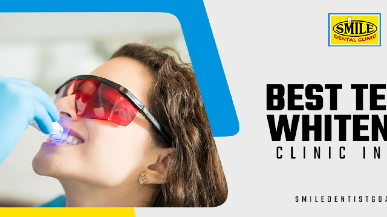 best teeth whitening clinic in Goa