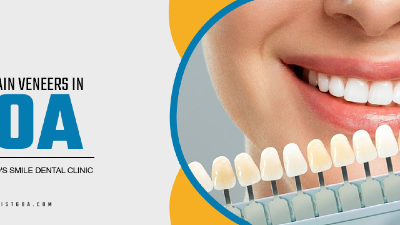 porcelain veneers in goa