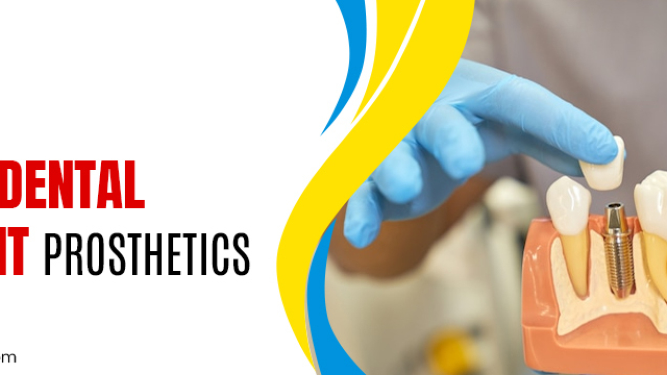 What is Dental Implant Prosthetics