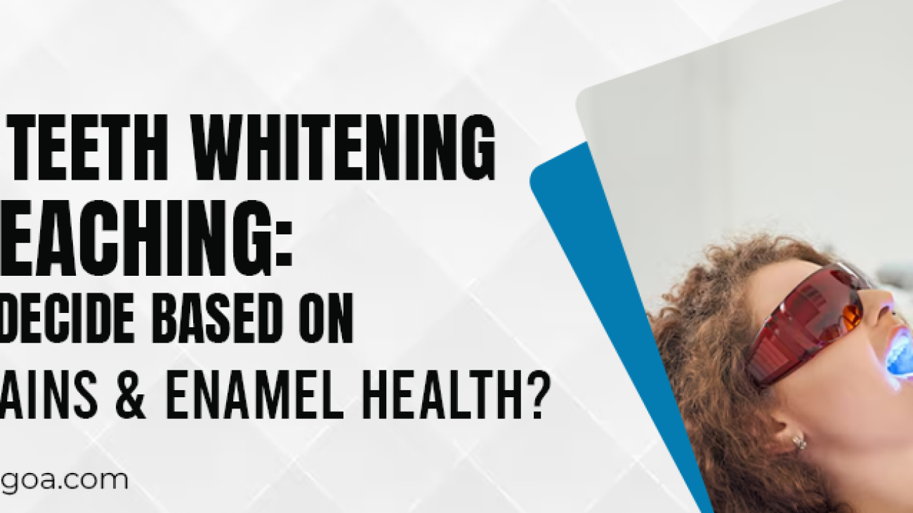Laser Teeth Whitening vs Bleaching_ How to Decide Based on Your Stains & Enamel Health_