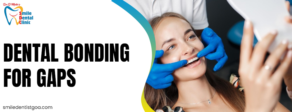 Dental bonding for gaps